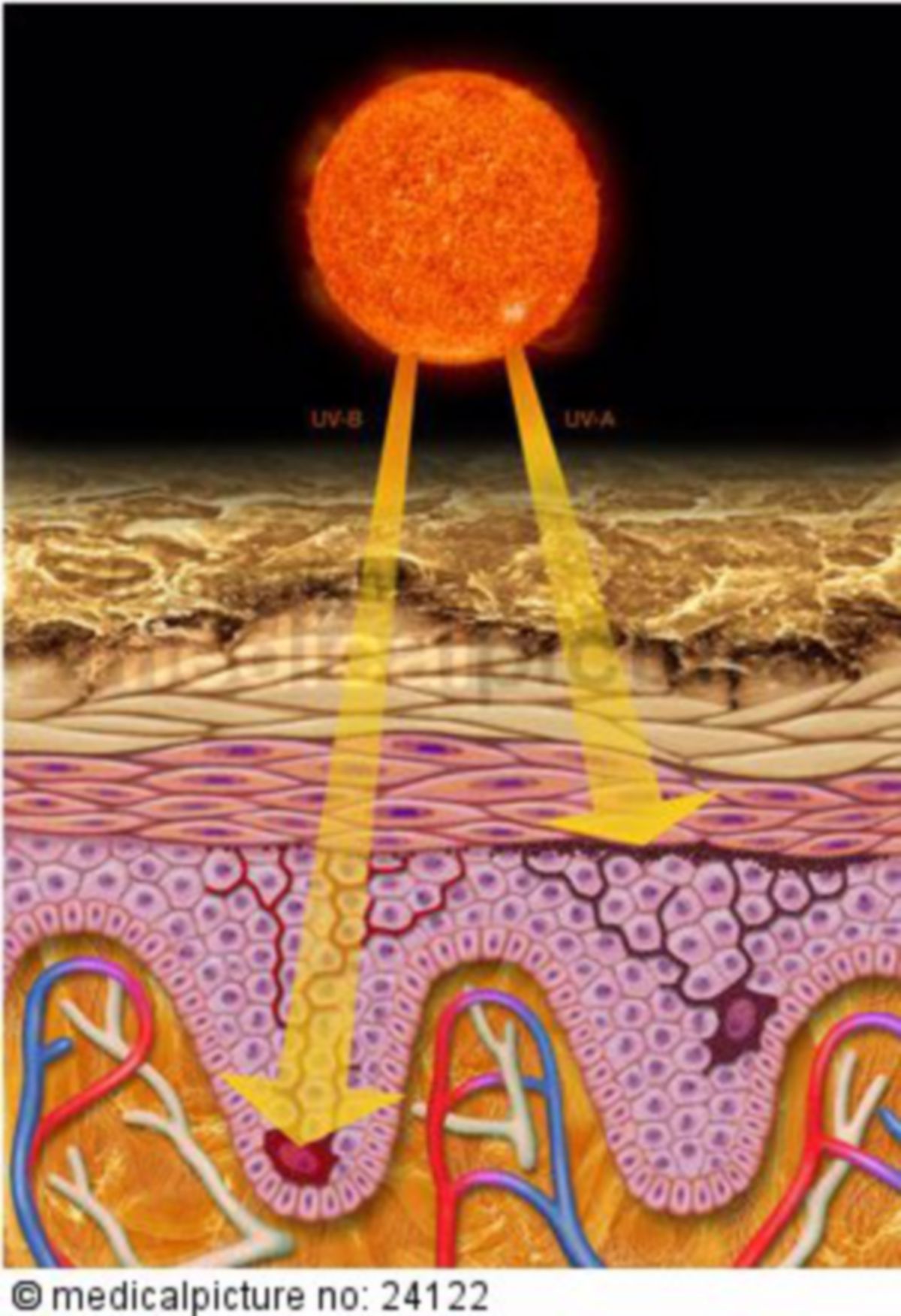  UV-Licht, Sonn und Epidermis 

