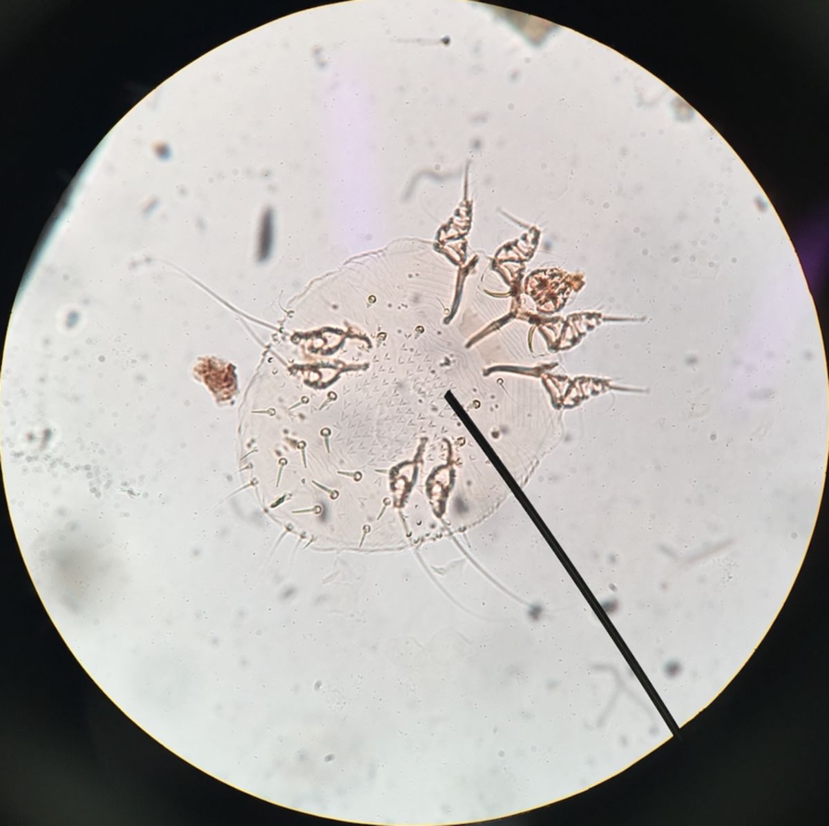 Sarcoptes scabiei (1/2)